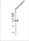 Complement C1q subcomponent subunit B antibody, TA325080, Origene, Western Blot image 