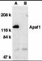 APAF antibody, TA319611, Origene, Western Blot image 