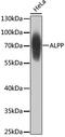 Alkaline Phosphatase, Placental antibody, 22-150, ProSci, Western Blot image 