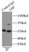 Lipopolysaccharide Binding Protein antibody, FNab04712, FineTest, Immunoprecipitation image 