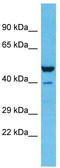 Zinc Finger Protein 589 antibody, TA331099, Origene, Western Blot image 