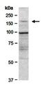 BLM RecQ Like Helicase antibody, orb66916, Biorbyt, Western Blot image 