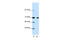 Nuclear Receptor Corepressor 2 antibody, 27-606, ProSci, Enzyme Linked Immunosorbent Assay image 