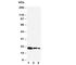 Fibroblast Growth Factor 7 antibody, R30439, NSJ Bioreagents, Western Blot image 