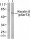 Keratin 8 antibody, TA313114, Origene, Western Blot image 