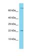 Nuclear Cap Binding Subunit 3 antibody, orb326786, Biorbyt, Western Blot image 