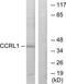 Atypical Chemokine Receptor 4 antibody, TA315481, Origene, Western Blot image 