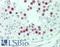 Synaptonemal Complex Central Element Protein 2 antibody, LS-B11235, Lifespan Biosciences, Immunohistochemistry paraffin image 