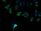 Phospholipid Phosphatase 2 antibody, A60362-100, Epigentek, Immunofluorescence image 