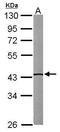 Isovaleryl-CoA Dehydrogenase antibody, TA308023, Origene, Western Blot image 