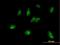 M-Phase Phosphoprotein 6 antibody, H00010200-B01P, Novus Biologicals, Immunocytochemistry image 