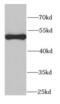 Proteasome 26S Subunit, ATPase 2 antibody, FNab06878, FineTest, Western Blot image 