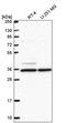 N(Alpha)-Acetyltransferase 35, NatC Auxiliary Subunit antibody, PA5-65672, Invitrogen Antibodies, Western Blot image 