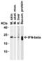 Interferon beta-1 antibody, 4243, ProSci Inc, Western Blot image 
