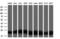 Dihydrofolate Reductase antibody, GTX84618, GeneTex, Western Blot image 