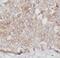 Epithelial Cell Adhesion Molecule antibody, FNab02799, FineTest, Immunohistochemistry frozen image 