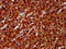 ETS Variant 5 antibody, CSB-PA007859LA01HU, Cusabio, Immunohistochemistry frozen image 