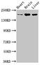 ADP Ribosylation Factor Guanine Nucleotide Exchange Factor 2 antibody, LS-C673673, Lifespan Biosciences, Western Blot image 