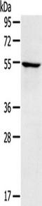 E3 ubiquitin-protein ligase TRIM22 antibody, TA351809, Origene, Western Blot image 
