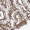 Coiled-Coil Domain Containing 18 antibody, NBP1-82504, Novus Biologicals, Immunohistochemistry paraffin image 