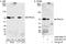 Protein phosphatase 1G antibody, A300-881A, Bethyl Labs, Immunoprecipitation image 