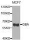Glucosylceramidase Beta antibody, LS-B14503, Lifespan Biosciences, Western Blot image 