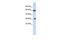 C-type lectin domain family 4 member M antibody, GTX47034, GeneTex, Western Blot image 