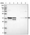 Small Nuclear Ribonucleoprotein U5 Subunit 40 antibody, PA5-55331, Invitrogen Antibodies, Western Blot image 