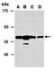 P21 (RAC1) Activated Kinase 2 antibody, orb67263, Biorbyt, Western Blot image 