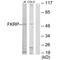 Fukutin Related Protein antibody, PA5-49880, Invitrogen Antibodies, Western Blot image 