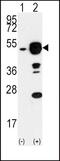 Eukaryotic Translation Initiation Factor 4A1 antibody, PA5-14113, Invitrogen Antibodies, Western Blot image 