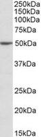 MON1 Homolog A, Secretory Trafficking Associated antibody, MBS422296, MyBioSource, Western Blot image 