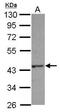 HAUS Augmin Like Complex Subunit 4 antibody, PA5-28494, Invitrogen Antibodies, Western Blot image 