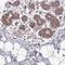 Abhydrolase Domain Containing 17C antibody, HPA048890, Atlas Antibodies, Immunohistochemistry frozen image 