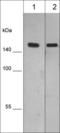 Desmoglein-1-alpha antibody, DM5931, ECM Biosciences, Western Blot image 