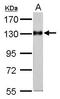 Amphiphysin antibody, TA308324, Origene, Western Blot image 