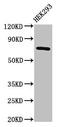 Acetoacetyl-CoA Synthetase antibody, CSB-PA001012LA01HU, Cusabio, Western Blot image 
