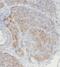 Coiled-Coil Domain Containing 51 antibody, FNab01360, FineTest, Immunohistochemistry paraffin image 