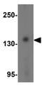 PR domain zinc finger protein 16 antibody, GTX03275, GeneTex, Western Blot image 