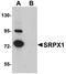 SRPX1 antibody, orb75305, Biorbyt, Western Blot image 
