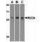 Receptor-interacting serine/threonine-protein kinase 2 antibody, TA305984, Origene, Western Blot image 