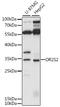 Olfactory Receptor Family 2 Subfamily S Member 2 (Gene/Pseudogene) antibody, A15368, Boster Biological Technology, Western Blot image 