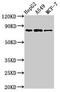 Nucleoporin GLE1 antibody, orb30685, Biorbyt, Western Blot image 