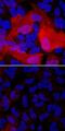 S100 Calcium Binding Protein A4 antibody, MAB4137, R&D Systems, Immunofluorescence image 
