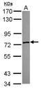 Zinc Finger SWIM-Type Containing 2 antibody, NBP2-21056, Novus Biologicals, Western Blot image 