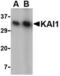 CD82 antigen antibody, TA306407, Origene, Western Blot image 
