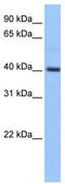 Pyridoxal kinase antibody, TA335765, Origene, Western Blot image 