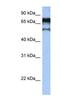 Zinc Finger Protein 780B antibody, NBP1-79348, Novus Biologicals, Western Blot image 
