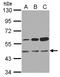 3-Oxoacyl-ACP Synthase, Mitochondrial antibody, LS-C155758, Lifespan Biosciences, Western Blot image 