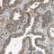 SEC62 Homolog, Preprotein Translocation Factor antibody, HPA014059, Atlas Antibodies, Immunohistochemistry frozen image 